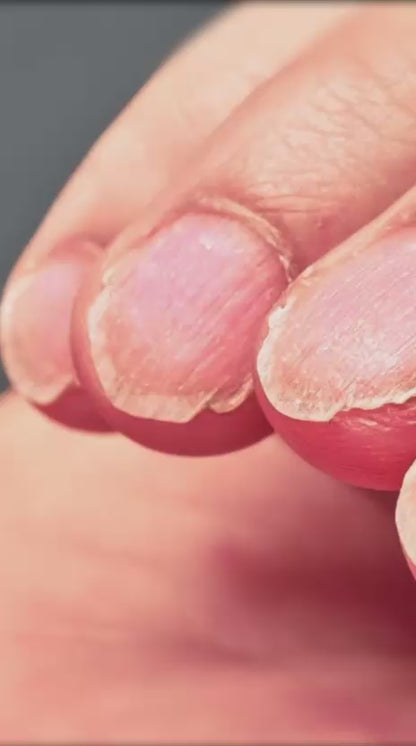 Reparador e Fortalecedor de Unhas Danificadas por Fungos e Micoses Nail Repair Vizbelle 30ml